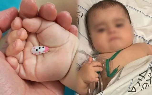 Bacısının dırnağı 6 aylıq körpəni xəstəxanalıq etdi - Foto